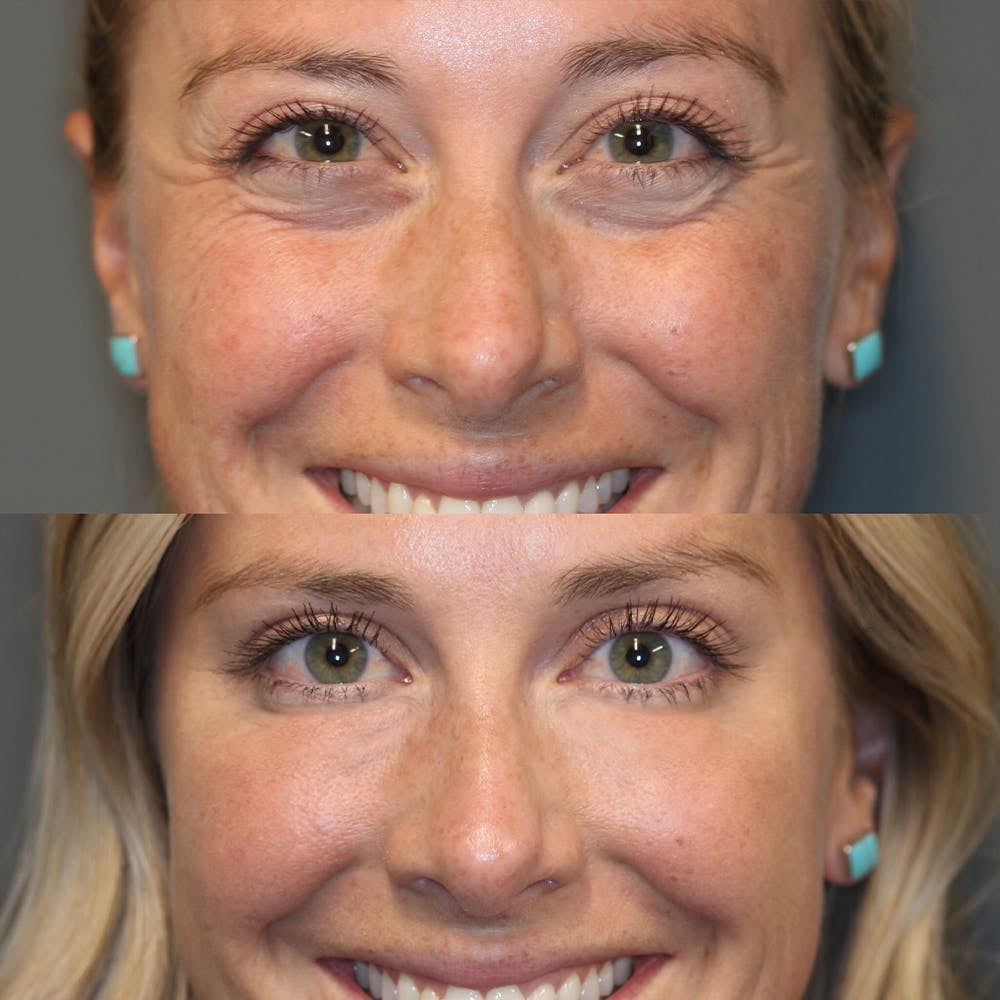 alwaysdwell™ - Retinol Eye Cream Stick