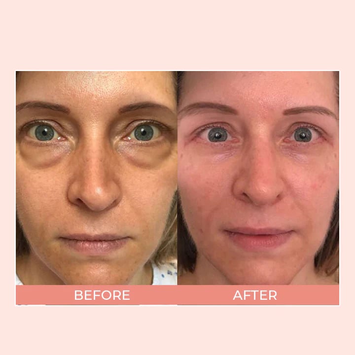 alwaysdwell™ - Retinol Eye Cream Stick