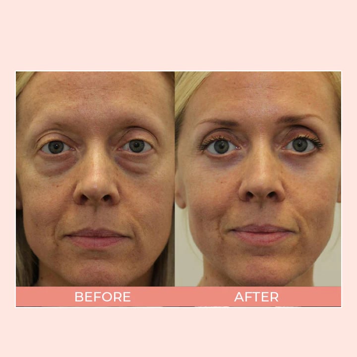 alwaysdwell™ - Retinol Eye Cream Stick