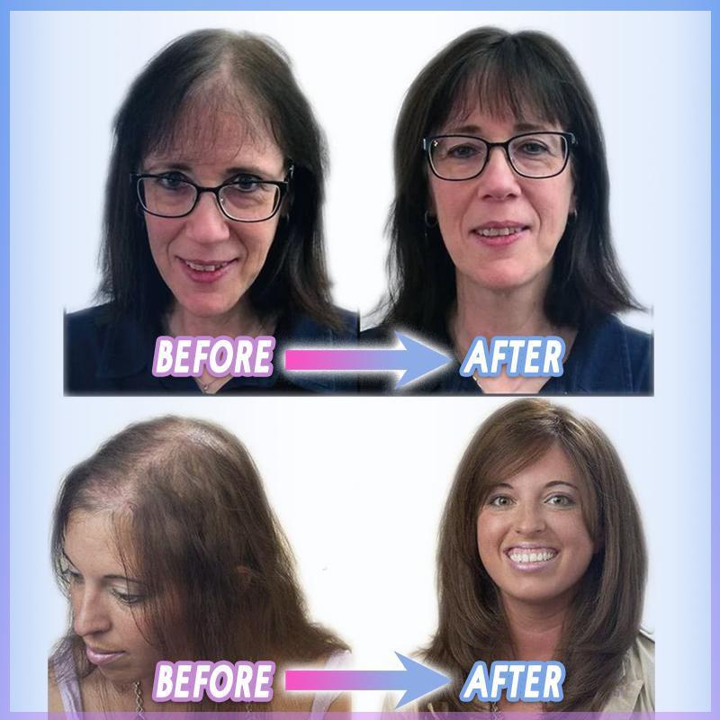 alwaysdwell™ - Magic Clip-on Hair Topper