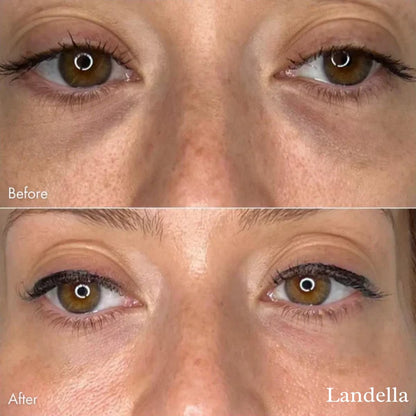 AlwaysdwellTM - 🔥Hot Sale 49% OFF💥Landella MicroGlow Patches